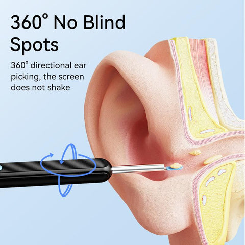 Smart Ear Cleaner with Camera & LED Light Wireless Ear Wax Removal Tool USB Rechargeable