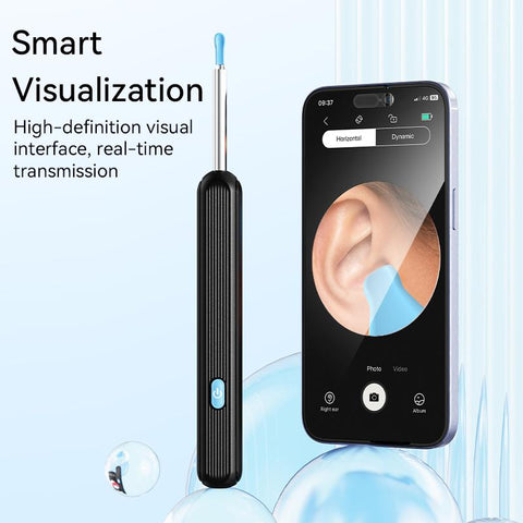 Smart Ear Cleaner with Camera & LED Light Wireless Ear Wax Removal Tool USB Rechargeable